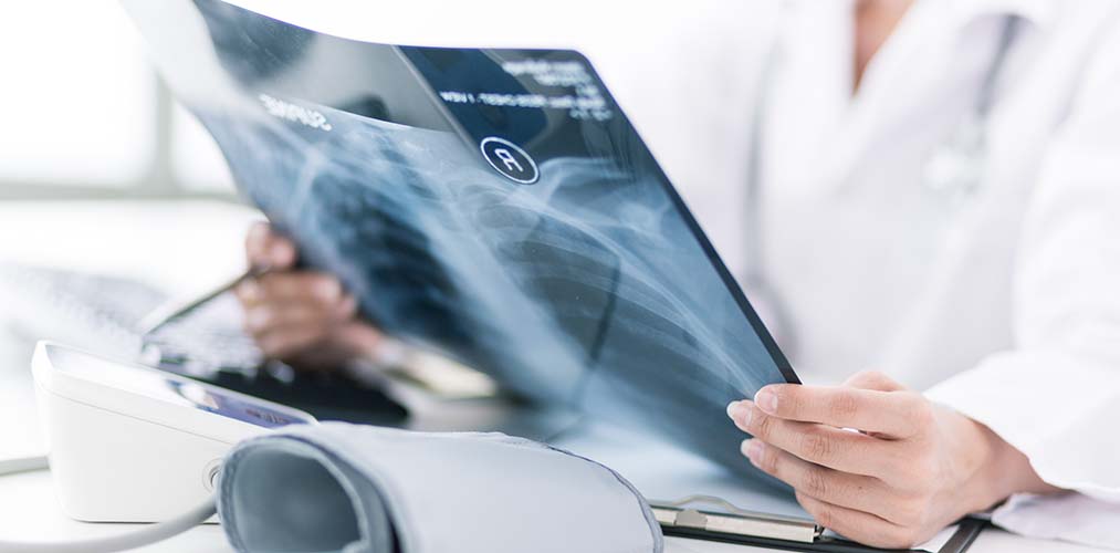 Doctor reviewing x-ray scan of lungs